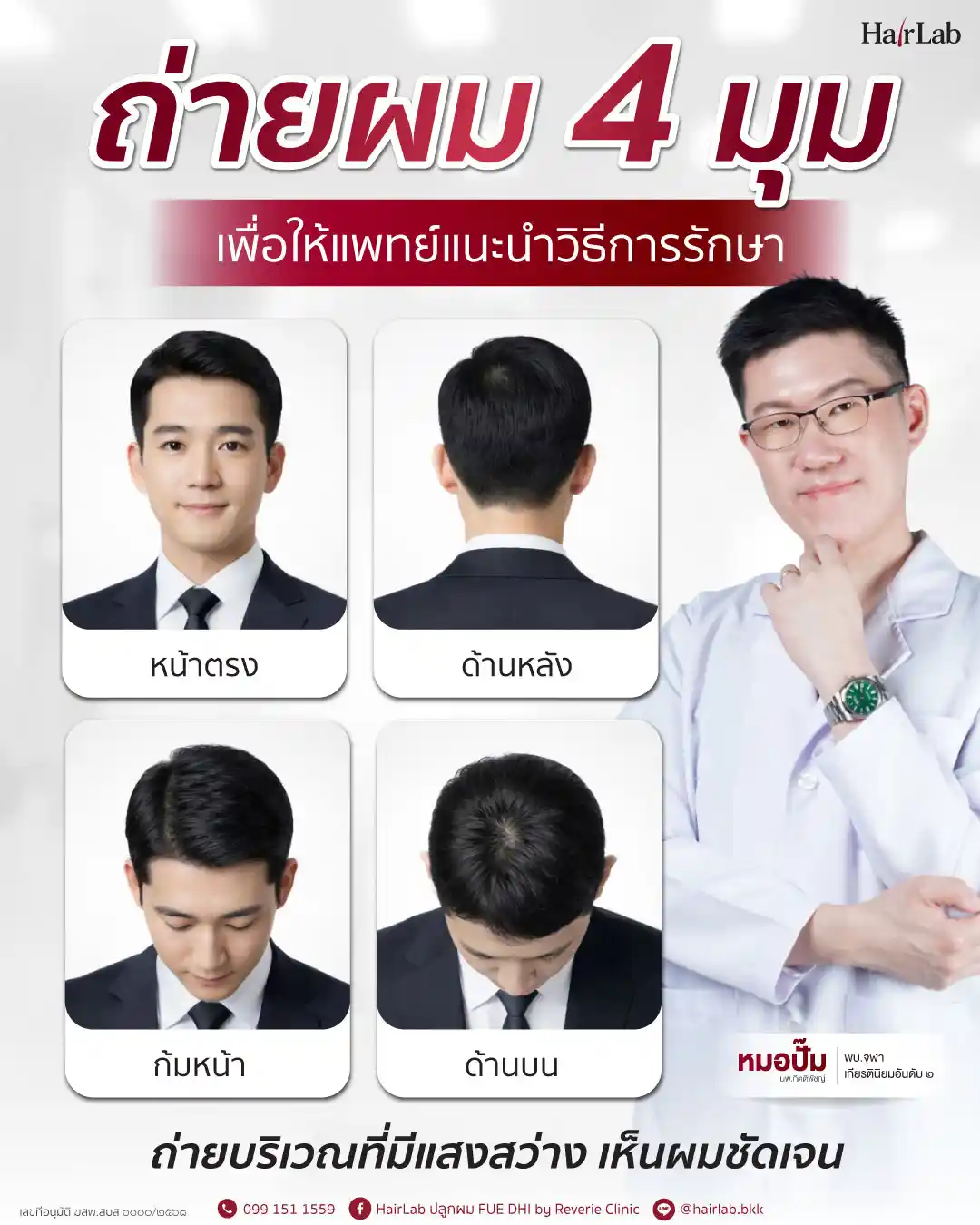ภาพถ่ายผม 4 มุมเพื่อให้แพทย์แนะนำวิธีรักษา