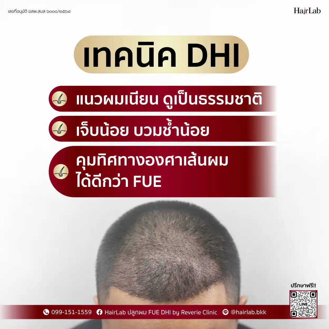 ข้อดีเทคนิค DHI