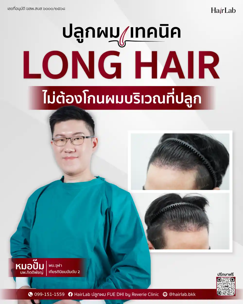 ปลูกผมเทคนิค Long Hair