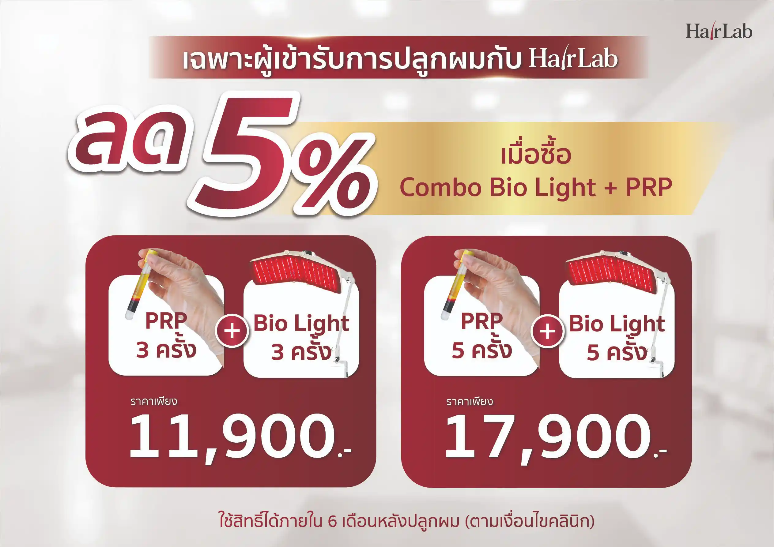 ส่วนลดพิเศษหลังการปลูกผม