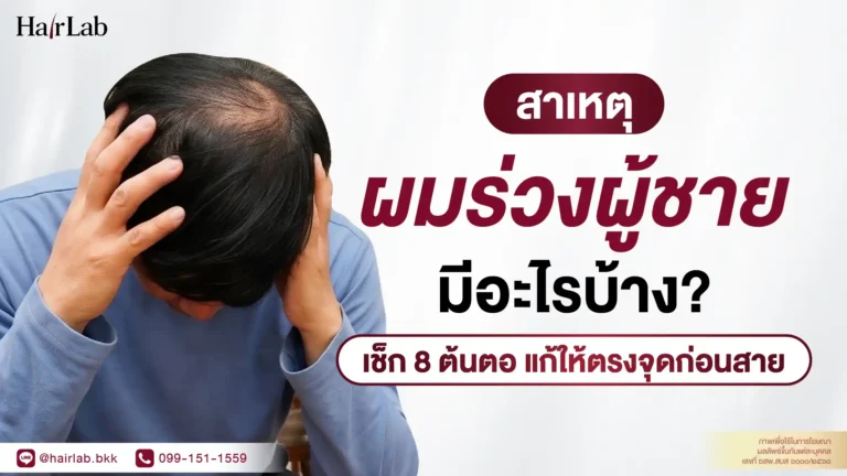 สาเหตุผมร่วงในผู้ชาย มีอะไรบ้าง? เช็ก 8 ต้นตอ แก้ให้เหมาะสมก่อนสาย
