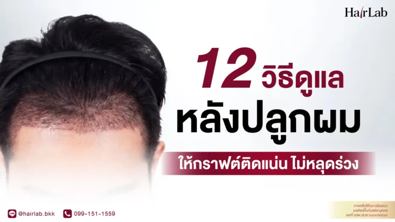 12 วิธีดูแลหลังปลูกผม ลดหลุดร่วง ให้กราฟต์แข็งแรง