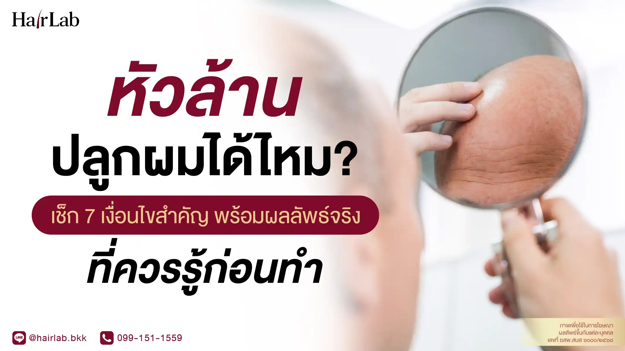 หัวล้านปลูกผมได้ไหม? เช็ก 7 เงื่อนไขสำคัญ พร้อมผลลัพธ์จริงที่ควรรู้ก่อนทำ