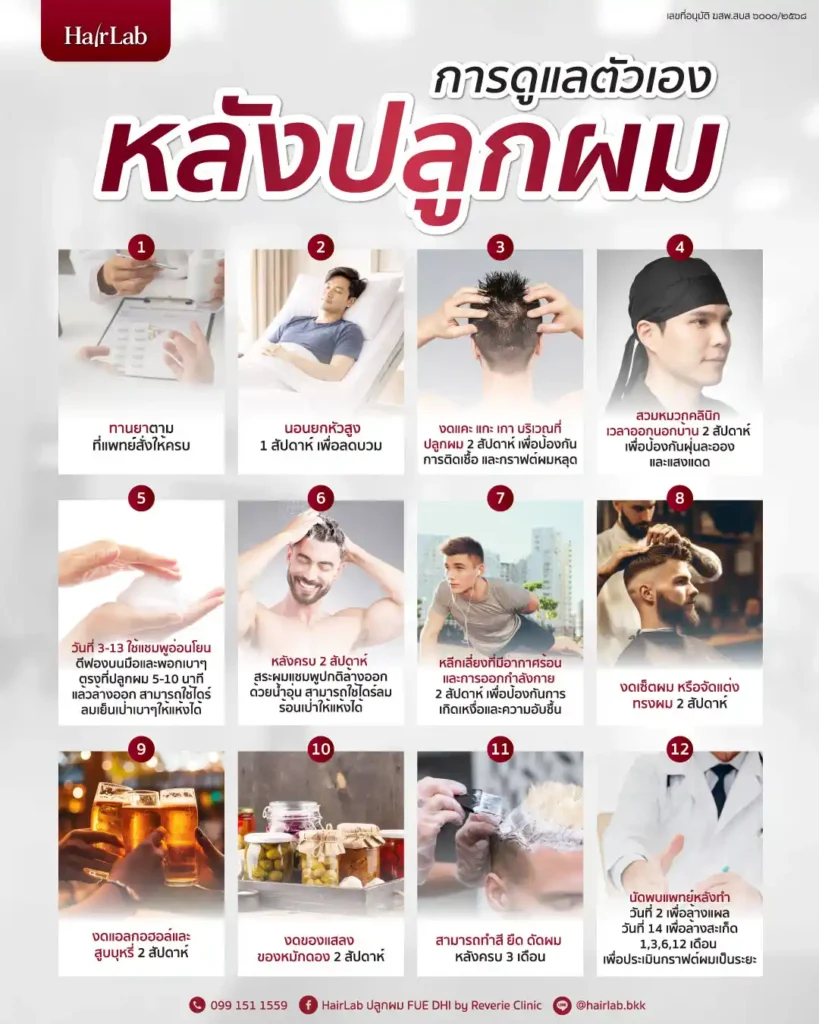 วิธีดูแลหลังปลูกผม