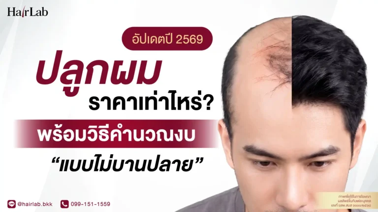 ปลูกผมราคาเท่าไหร่? อัปเดตปี 2569 พร้อมวิธีคำนวณงบแบบไม่บานปลาย