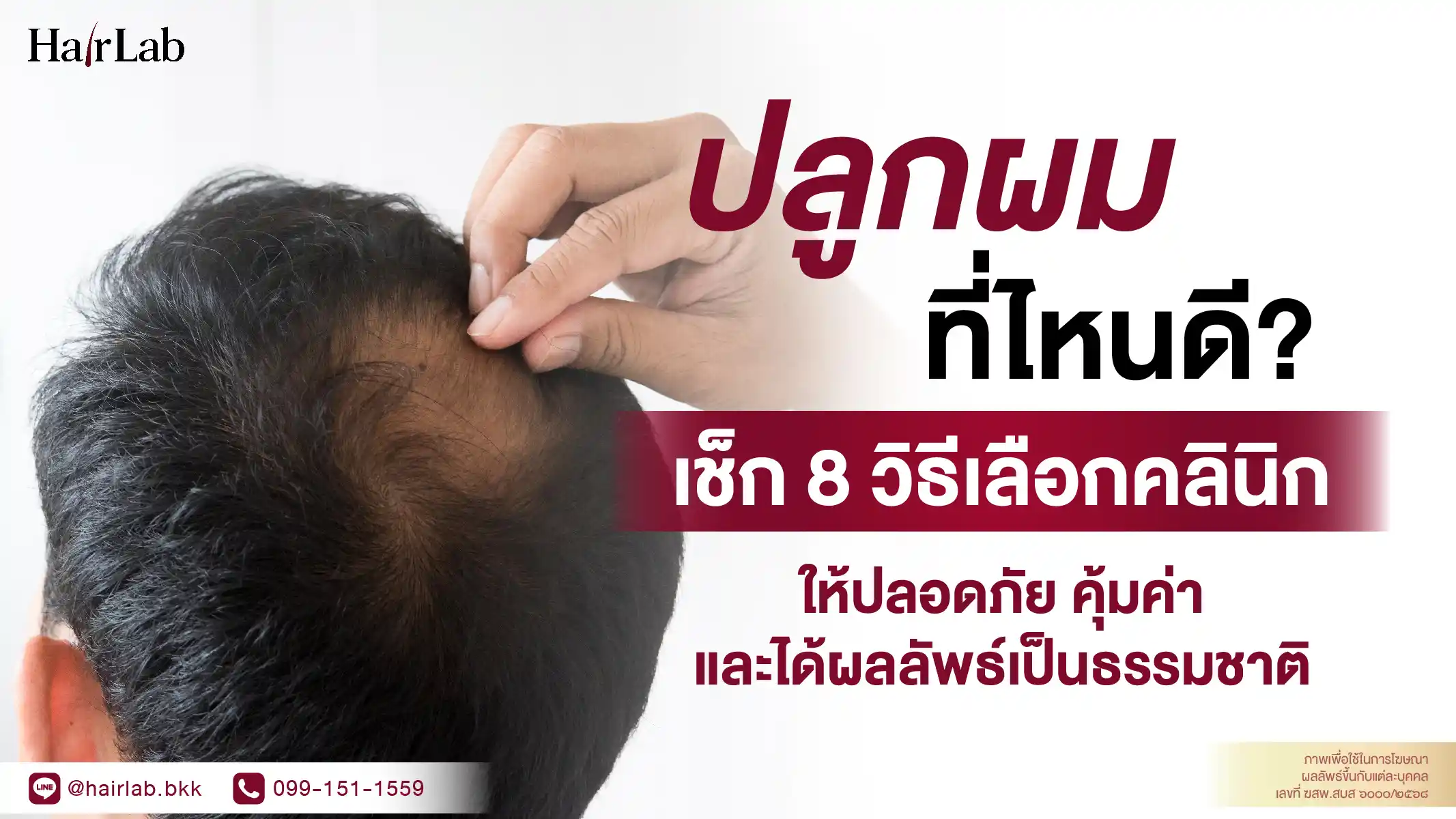 ปลูกผมที่ไหนดี? เช็ก 8 วิธีเลือกคลินิกให้ปลอดภัย คุ้มค่า และได้ผลลัพธ์เป็นธรรมชาติ