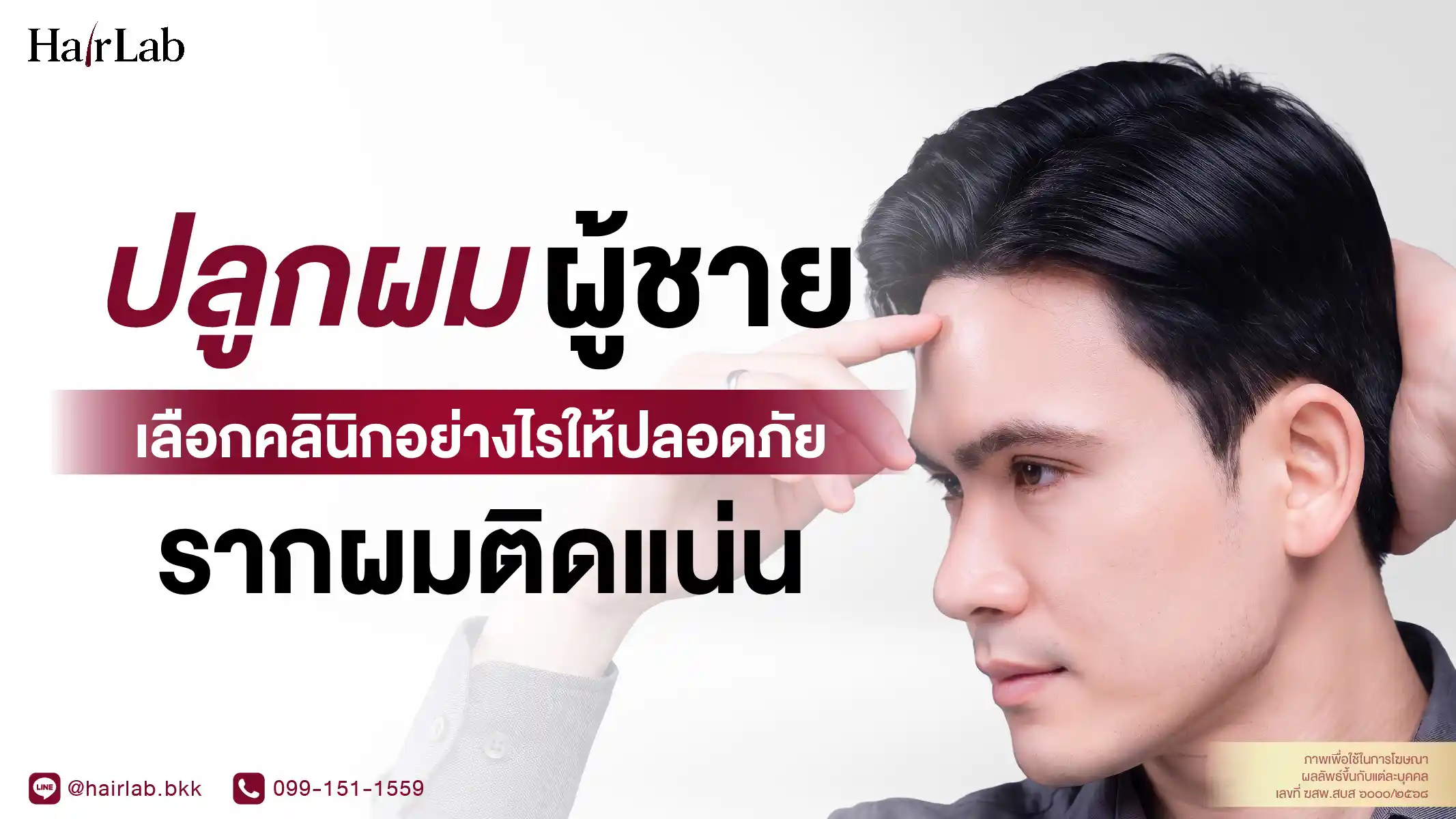 ปลูกผมผู้ชาย เลือกคลินิกอย่างไรให้ปลอดภัย? อัปเดต 3 เทคนิคให้ผลลัพธ์ดูเรียบเนียน