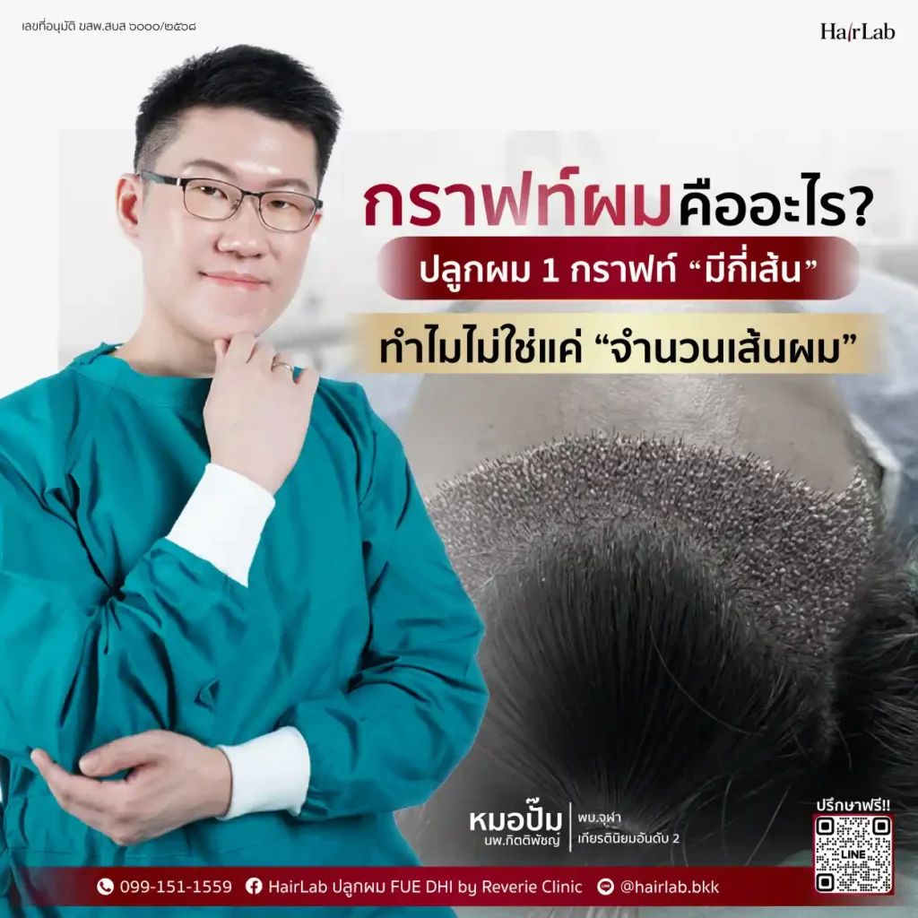 กราฟต์ผม คืออะไร
