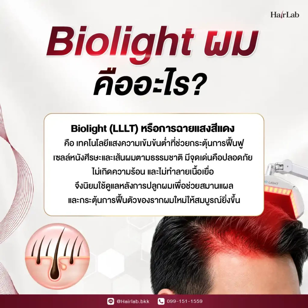 Biolight ผม คืออะไร