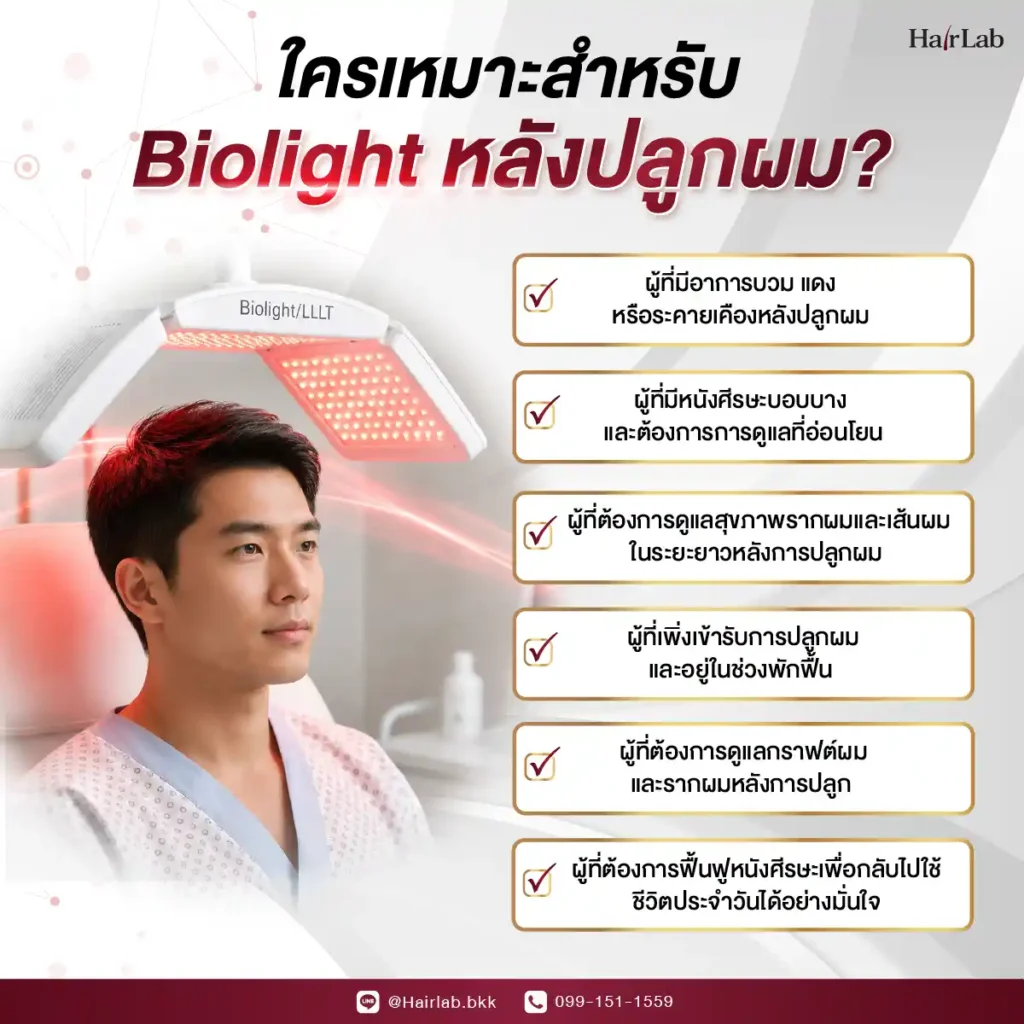 คนที่เหมาะกับโปรแกรมฉายแสง Biolight ผม หลังปลูกผม