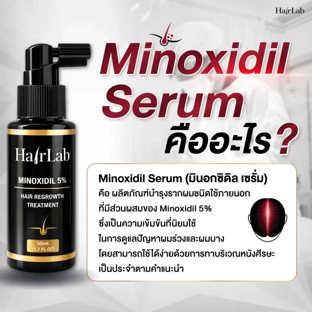 Minoxidil Serum คืออะไร
