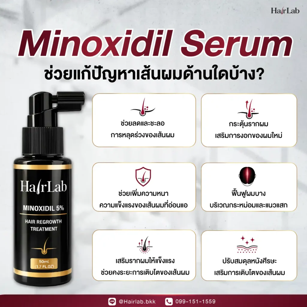 Minoxidil Serum ช่วยแก้ปัญหาเส้นผมด้านใดบ้าง