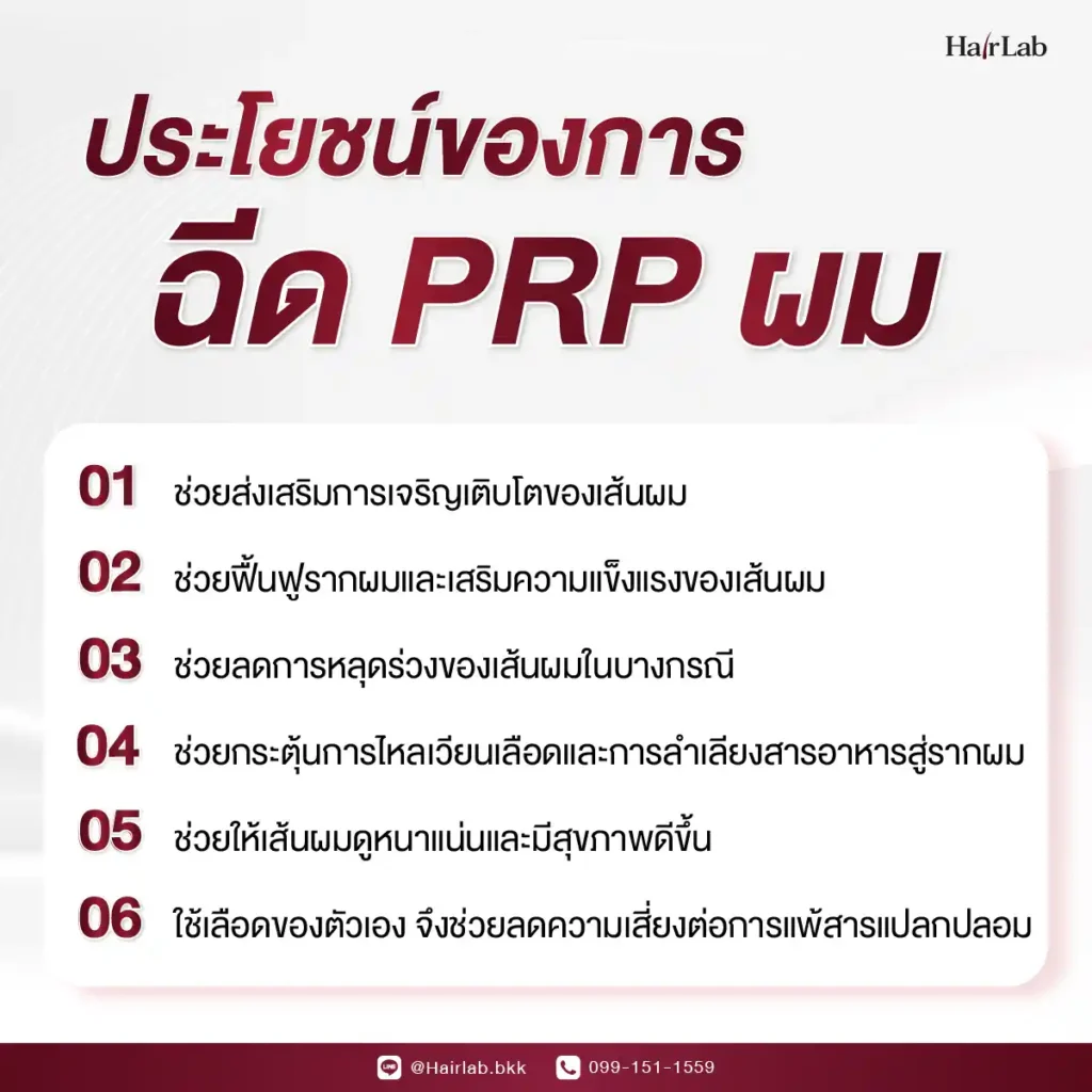 ประโยชน์ของการฉีด PRP ผม