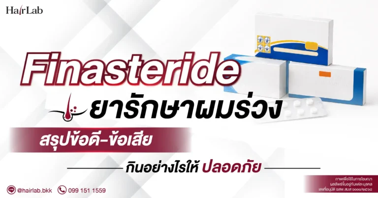 ยา Finasteride รักษาผมร่วง สรุปข้อดี-ข้อเสีย และแนวทางการใช้ยา