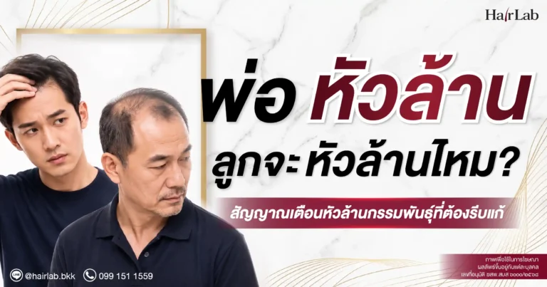 พ่อหัวล้าน ลูกจะหัวล้านไหม? สัญญาณเตือนหัวล้านกรรมพันธุ์ที่ต้องรีบแก้