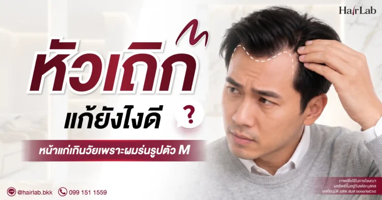 “หัวเถิก” แก้ยังไงดี? หน้าแก่เกินวัยเพราะผมร่นรูปตัว M