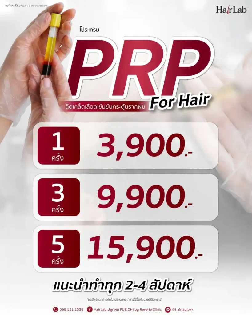 ค่าใช้จ่ายในการฉีด PRP ผม