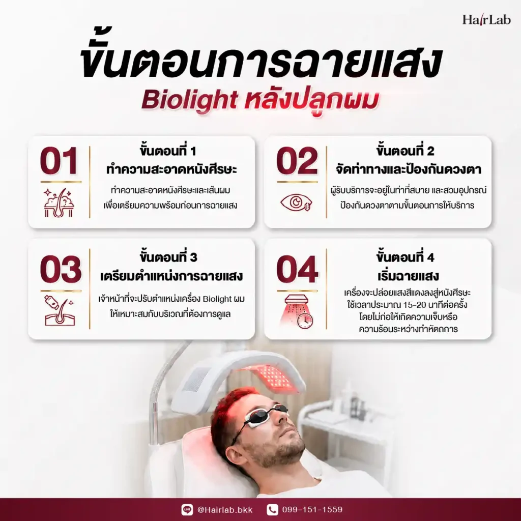 ขั้นตอนการฉายแสง biolight