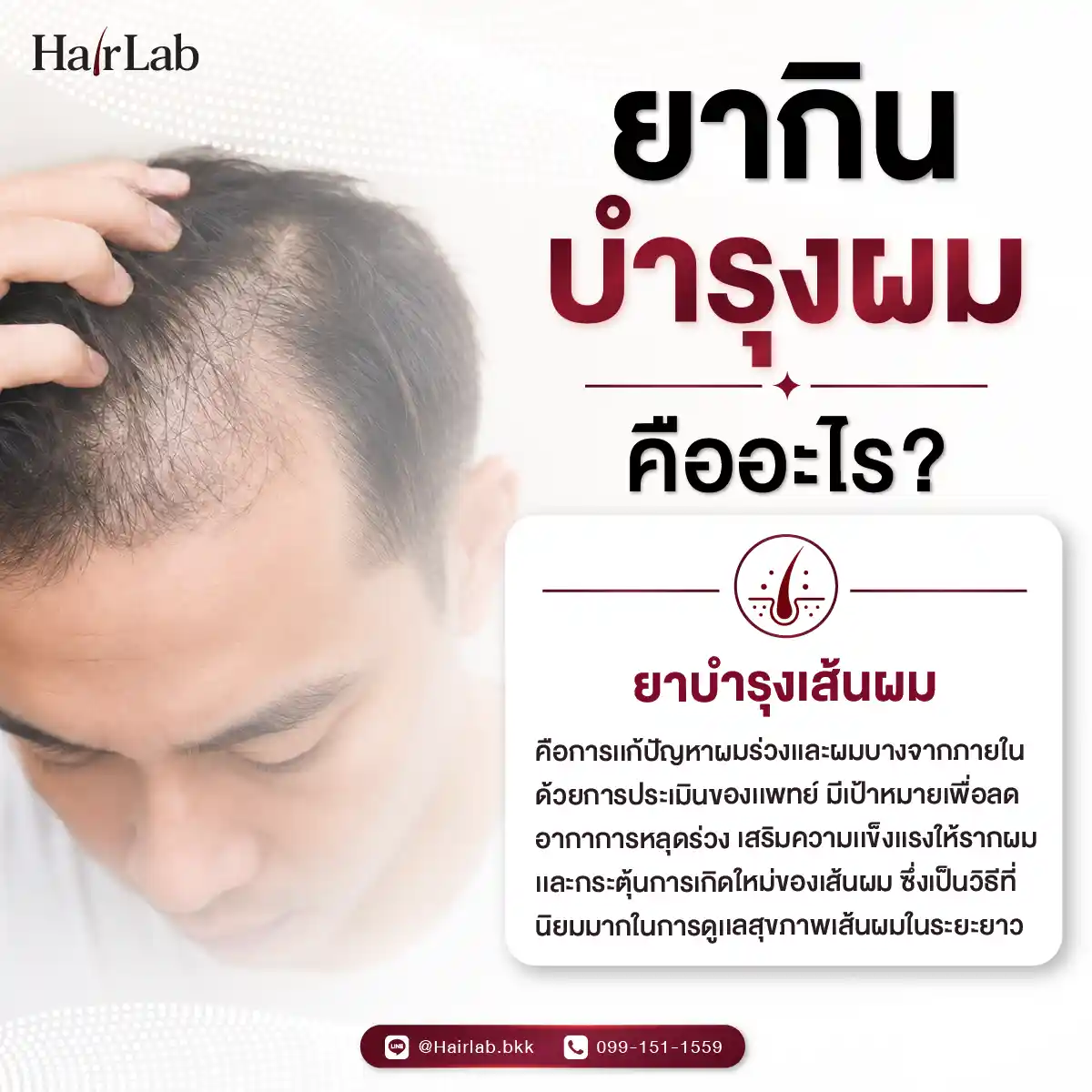 ยากินบำรุงผม คืออะไร