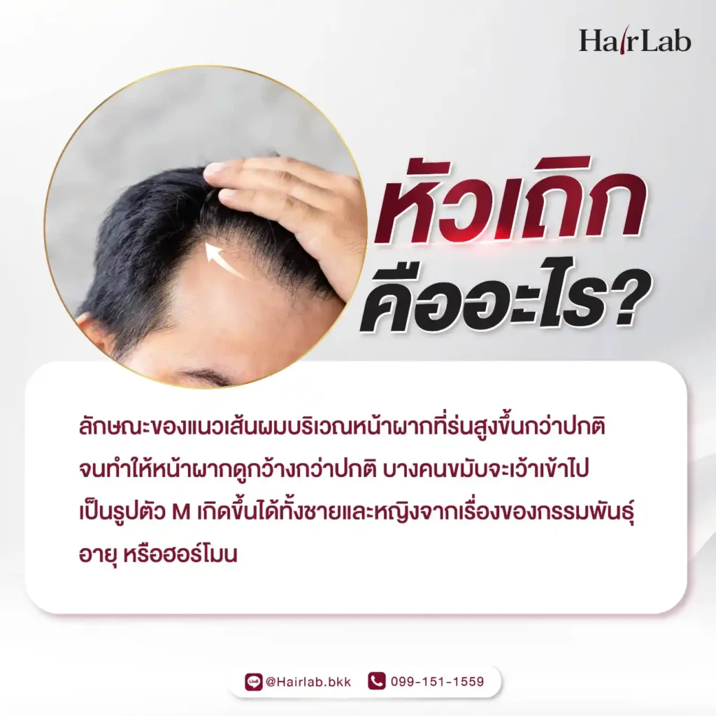 หัวเถิก คืออะไร