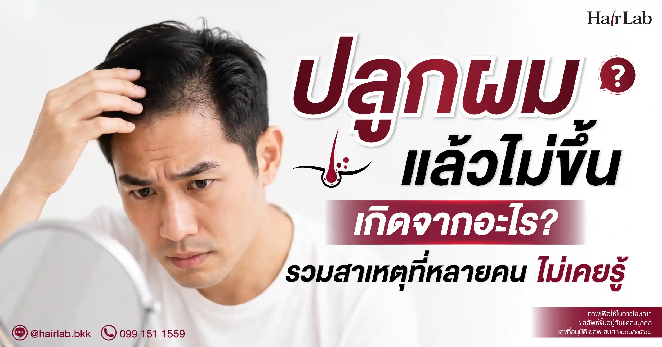 ปลูกผมแล้วไม่ขึ้น เกิดจากอะไร? รวมสาเหตุที่หลายคนไม่เคยรู้