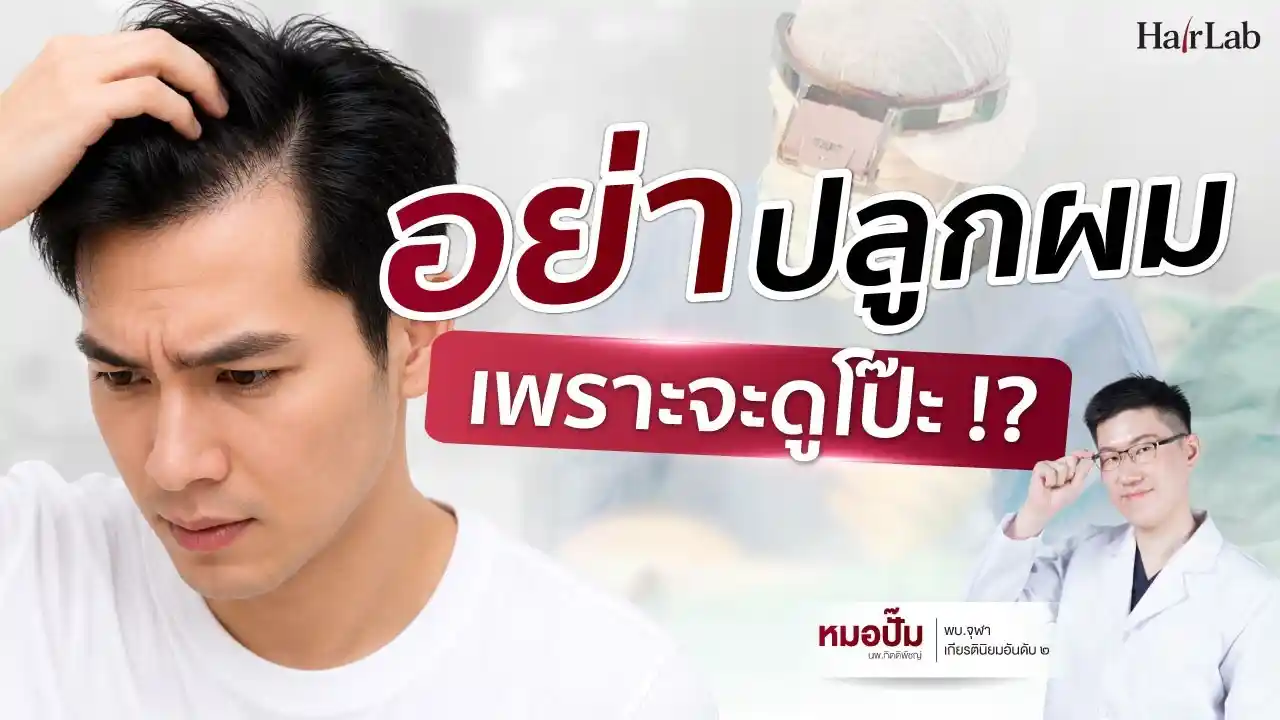 ปลูกผมแล้วดูโป๊ะ…อะไรทำให้คนจับได้?
