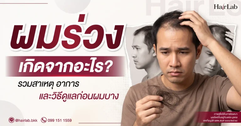 ผมร่วงเกิดจากอะไร? รวมสาเหตุ อาการ และวิธีดูแลก่อนผมบาง