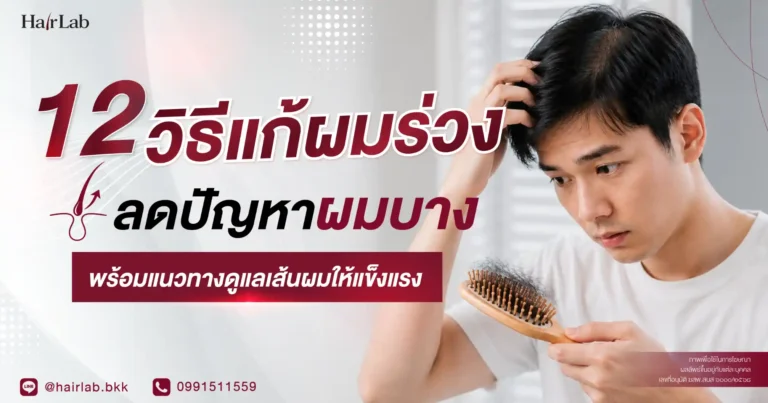 12 วิธีแก้ผมร่วง ลดปัญหาผมบาง พร้อมแนวทางดูแลเส้นผมให้แข็งแรง