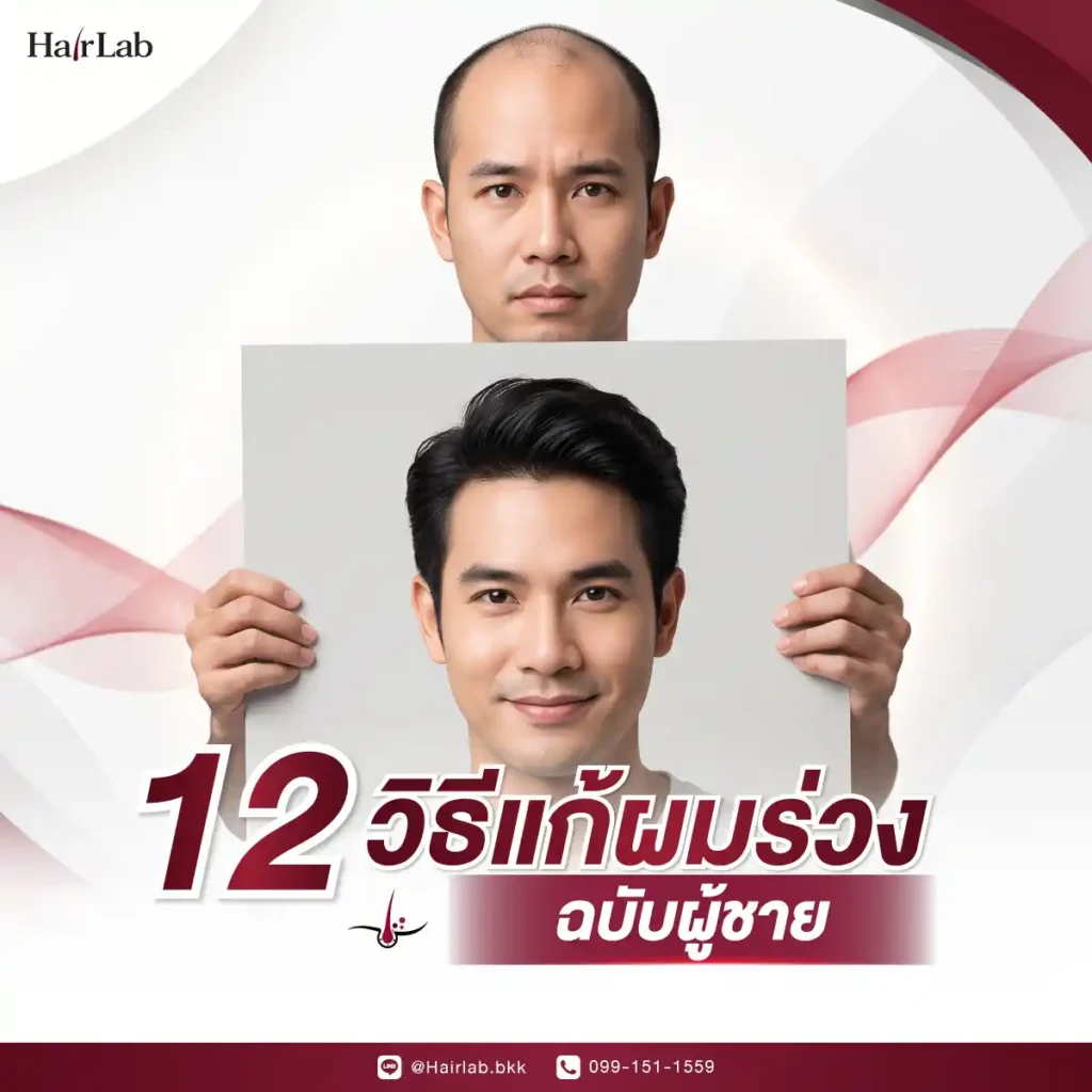 วิธีแก้ผมร่วงในผู้ชาย