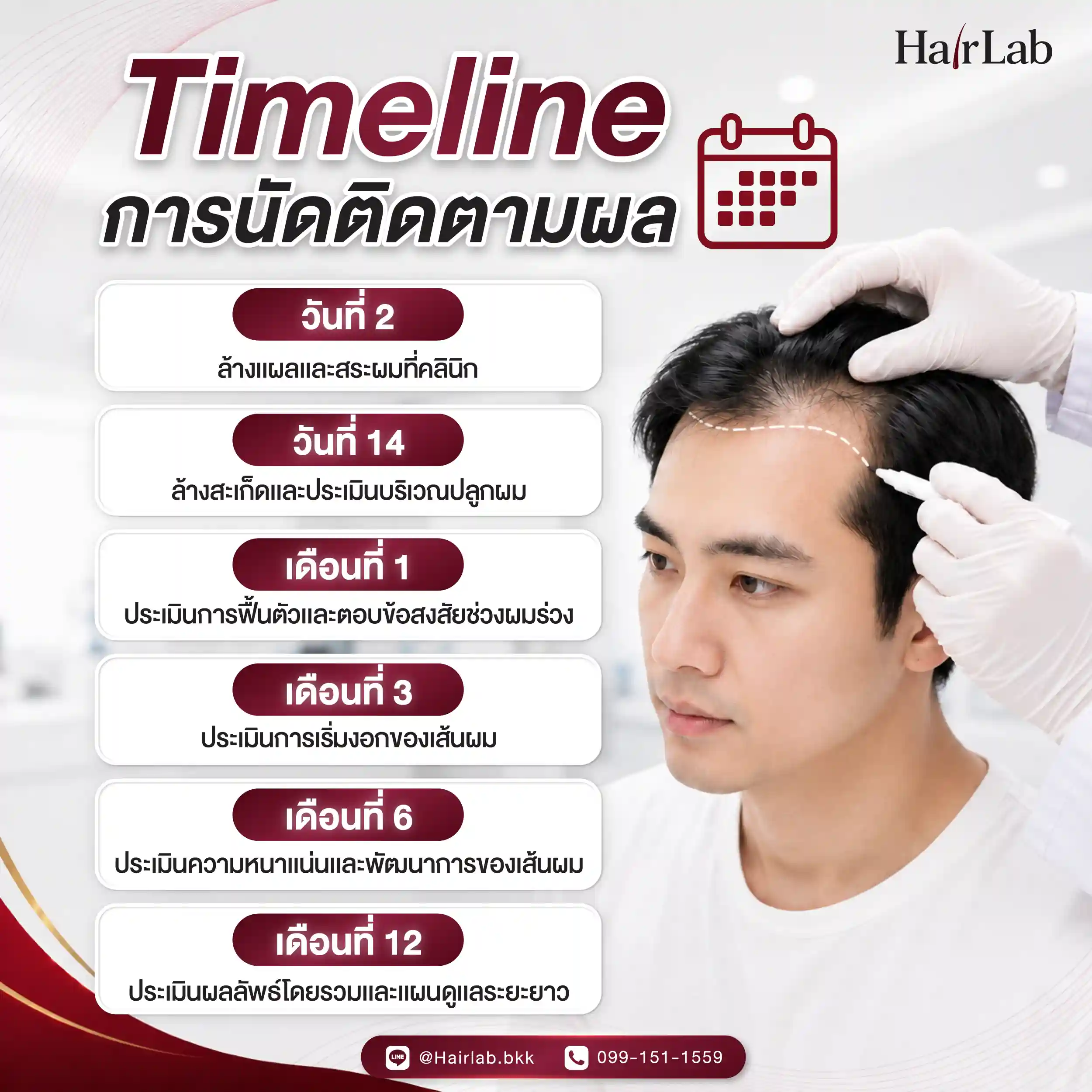 ไทม์ไลน์นัดติดตามผลหลังปลูกผม HairLab