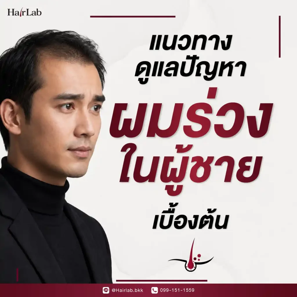 แนวทางดูแลปัญหาผมร่วงในผู้ชายเบื้องต้น