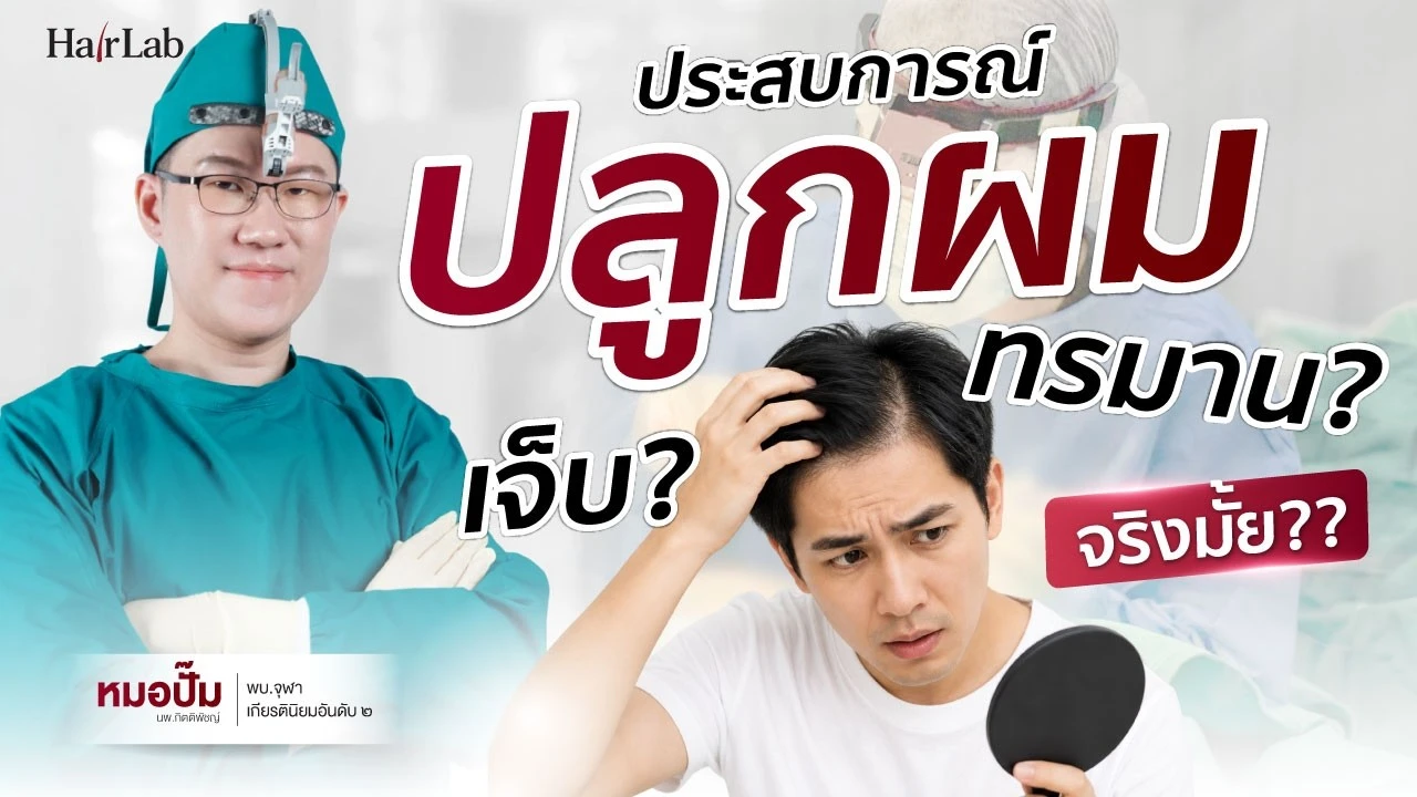 ประสบการณ์ปลูกผม เจ็บจริงไหม?