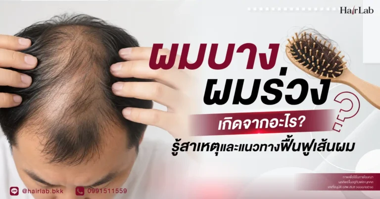 ผมบาง ผมร่วง เกิดจากอะไร? รู้สาเหตุและแนวทางฟื้นฟูเส้นผม
