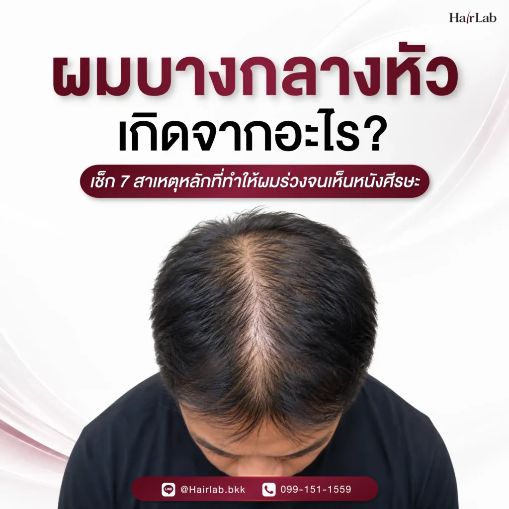 ผมบางกลางหัว เกิดจากอะไร