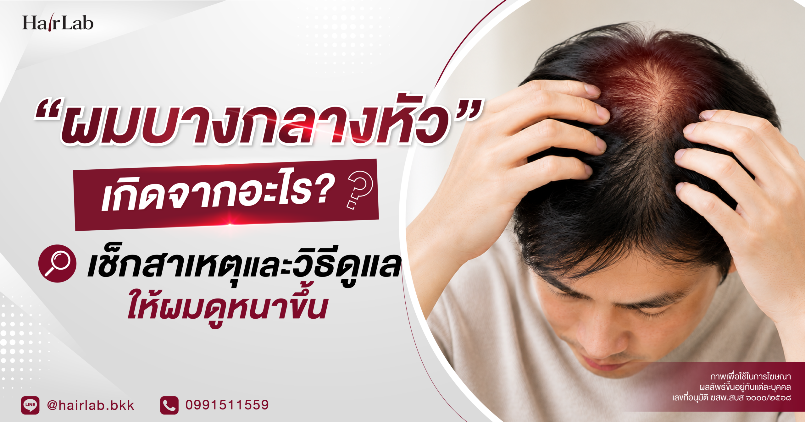 “ผมบางกลางหัว” เกิดจากอะไร? เช็กสาเหตุและวิธีดูแลให้ผมดูหนาขึ้น