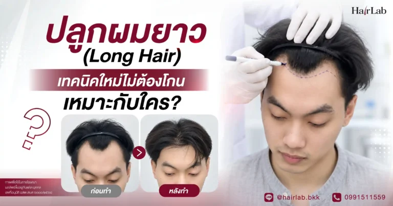 ปลูกผมยาว