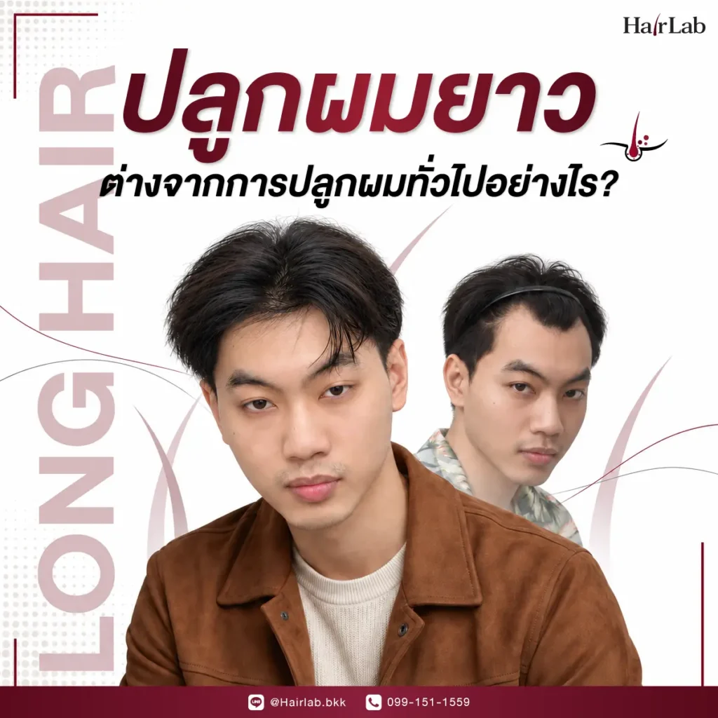 ปลูกผมยาวต่างจากการปลูกผมทั่วไปอย่างไร